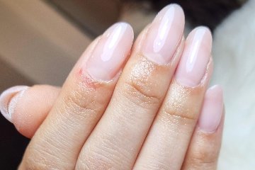 Prinkipissa nail's